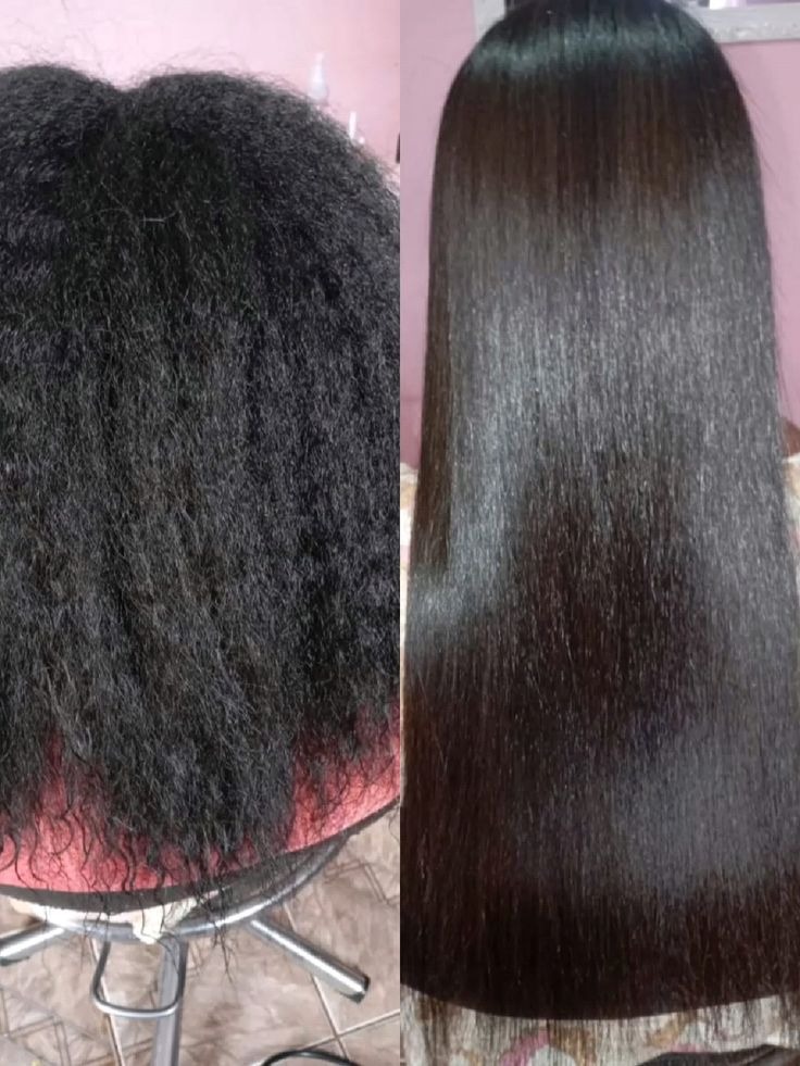 Antes e depois 2