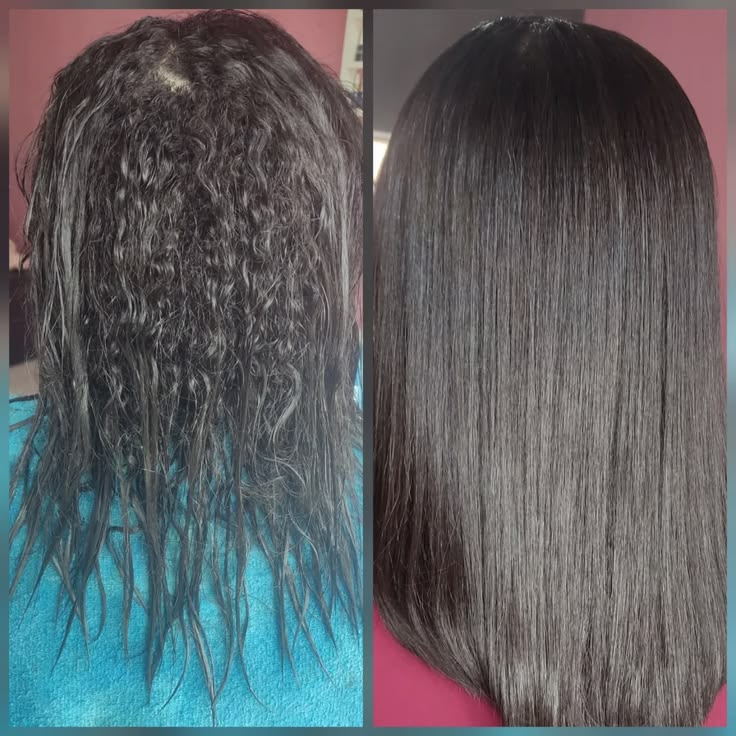 Antes e depois 1